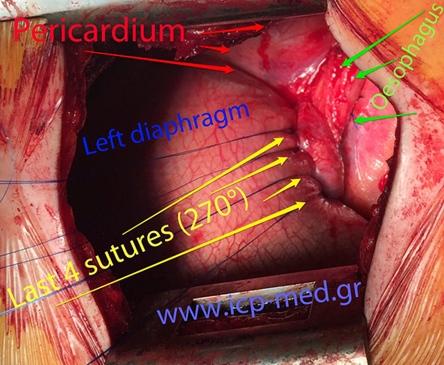 8. The same as image 7, with Arrows to explain the anatomical structures shown