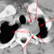 mediastinumposter10.jpg