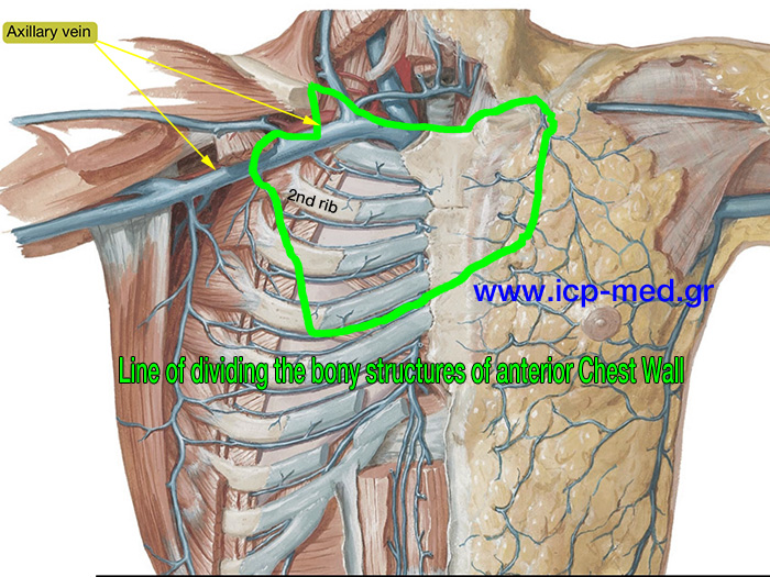 1. Γραμμή διατομής οστών προσθίου θωρακικού τοιχώματος