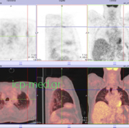 petct07.jpg