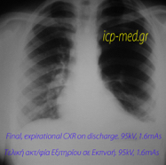 macleodcxr04expiratdischarge.jpg